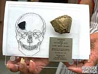 Skull chip from one of the victims